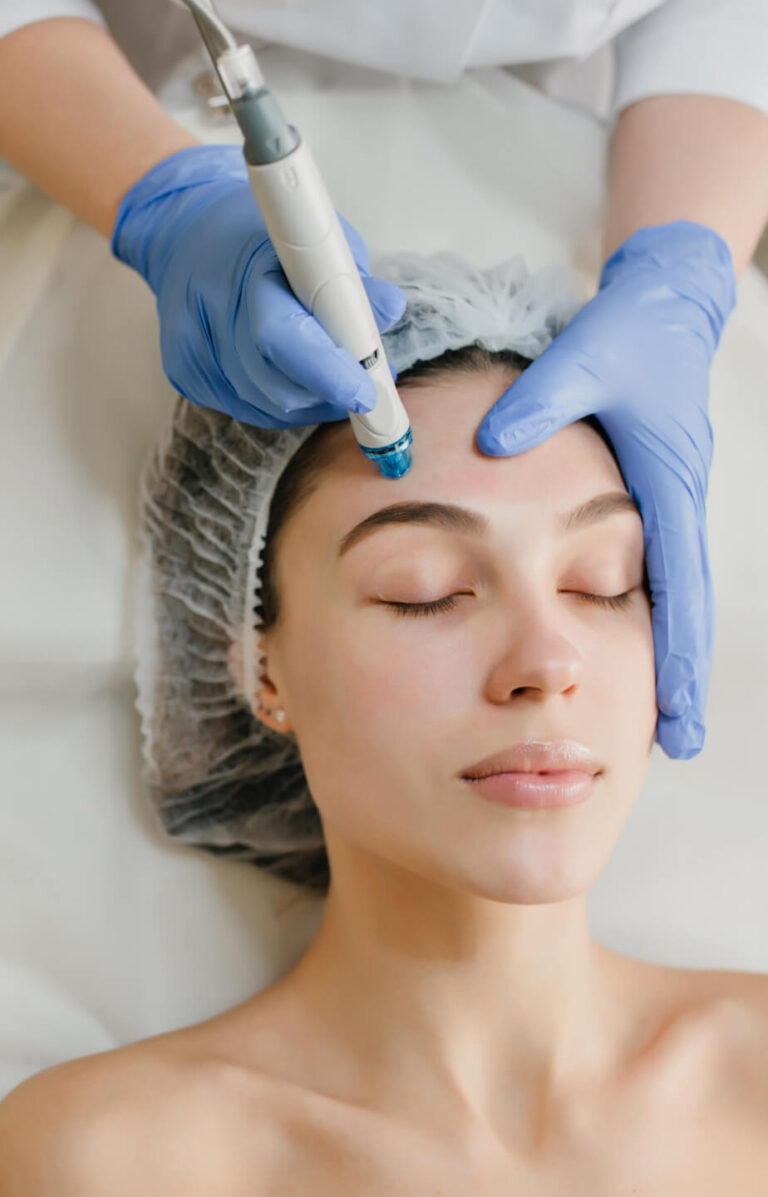 Dermapen zabieg dermapen