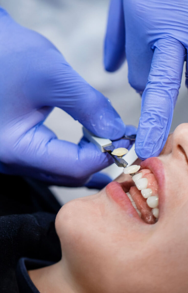 Stomatologia estetyczna Konin stomatologia estetyczna konin